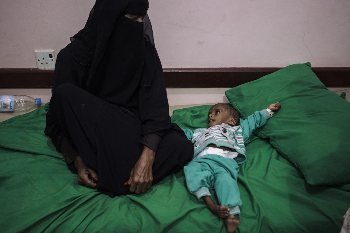 الوضع الإنساني في اليمن معاناة مستمرة