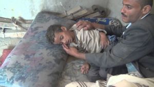 صنعاء.. تسجيل 33 حالة وفاة بداء الكلب خلال 2022