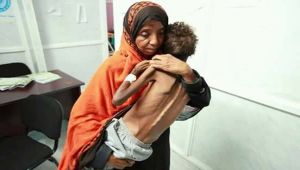 يونيسف: أطفال اليمن يعيشون في جحيم .. و30 ألف طفل يموتون كل عام