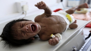 Millions in war-torn Yemen to face shortage of life-saving medicines, food on dearth of funds