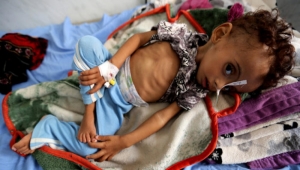 الأمم المتحدة:  أكثر من 12 مليون طفل في اليمن بحاجة إلى مساعدات عاجلة