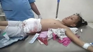 إصابة طفلة برصاص قناص حوثي في تعز