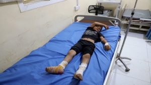 مرصد حقوقي: مقتل وإصابة 28 شخصا جراء الألغام خلال ديسمبر الماضي