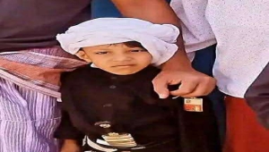 إصابة طفل برصاص اشتباكات قبلية في أبين