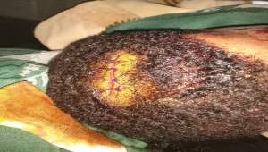 نقابة الصحفيين تدين الاعتداء الذي تعرض له مراسل "سهيل" في تعز