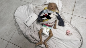 الرضيعة زينب أبو حليب.. ضحية جديدة لتجويع غزة