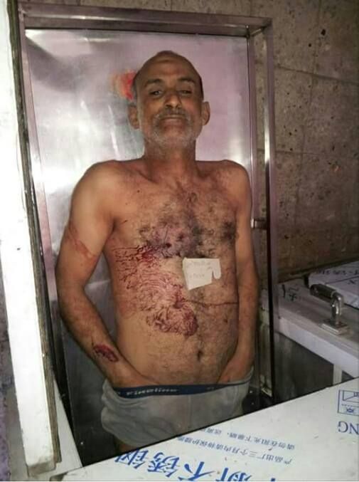 مقتل مشرف الحوثيين بمديرية السبرة في إب بعد إعتدائه على منزل شقيقه (صورة )