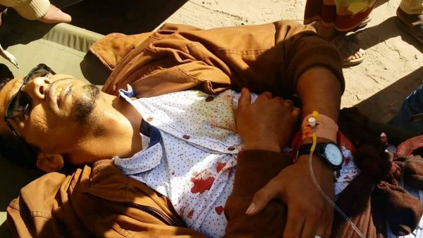 مقتل أربعة اشخاص جراء استهداف حافلة نقل جماعي من قبل مليشيا الحوثي في الضالع (صور)