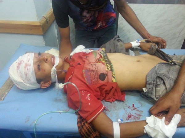 مقتل امرأة وطفلها وإصابة 16 مدنيا بقصف حوثي على حي سكني بتعز