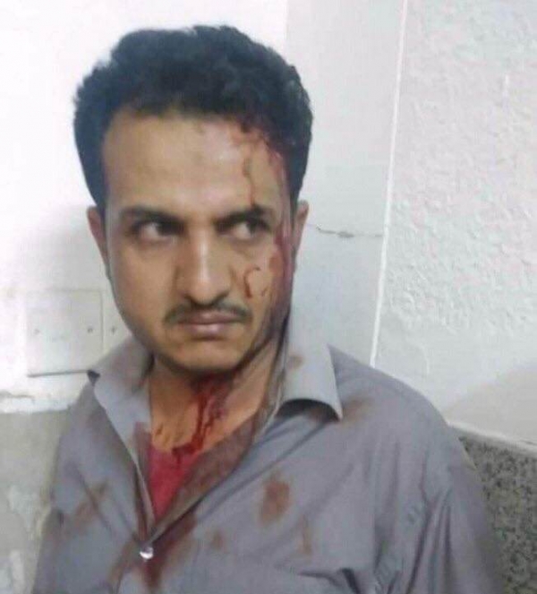 ردود منددة بعد اعتداء مشرف حوثي على طبيب في مستشفى الثورة بصنعاء