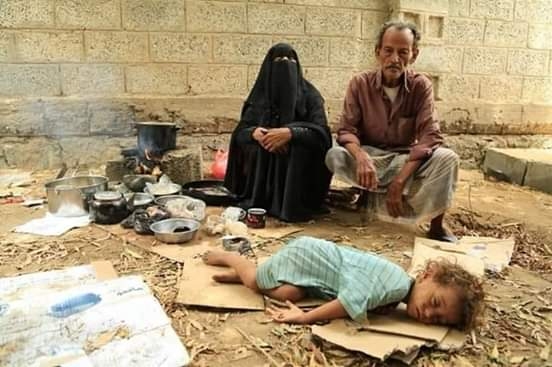 الأمم المتحدة: أكثر من 5 ملايين يمني يعيشون بمناطق يصعب الوصول إليها