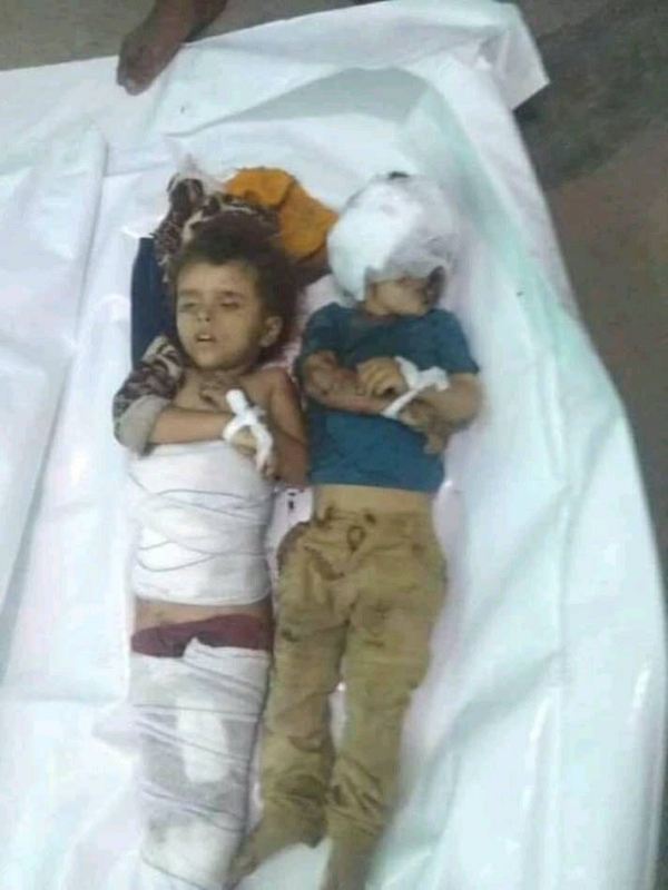 مقتل طفلين بقصف حوثي استهدف أحياء سكنية في تعز