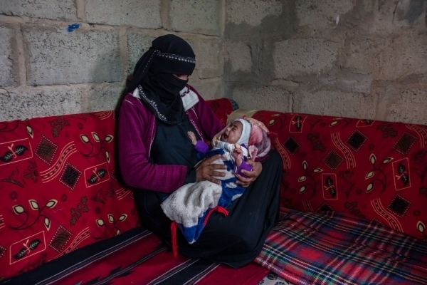 الأمم المتحدة: وفاة 12 امرأة يوميا بسبب الولادة في اليمن