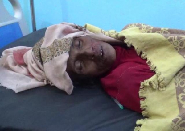 مقتل امرأة برصاص قناص حوثي في الحديدة