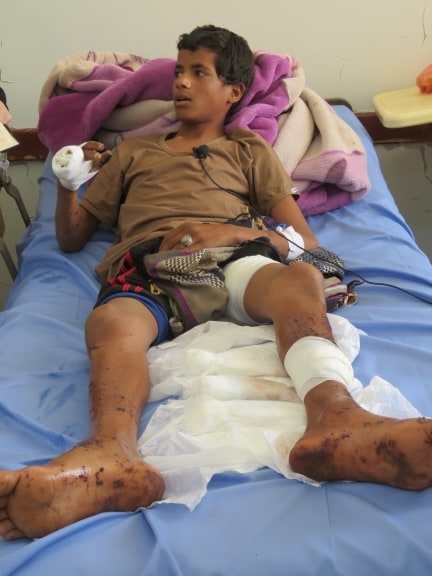 إصابة طفلين بانفجار لغم زرعه الحوثيون بمنطقة مجزر بمأرب