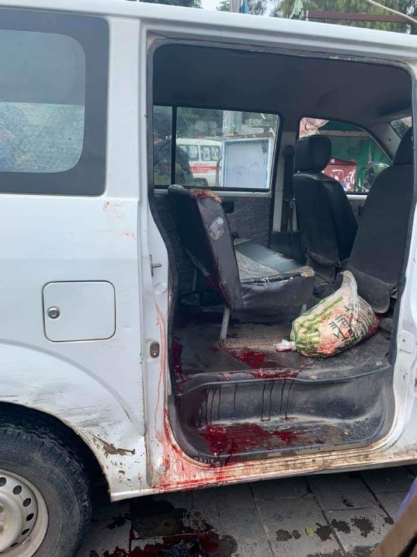 مقتل امرأة وزوجها وإصابة شخص آخر برصاص مسلح حوثي في مدينة إب