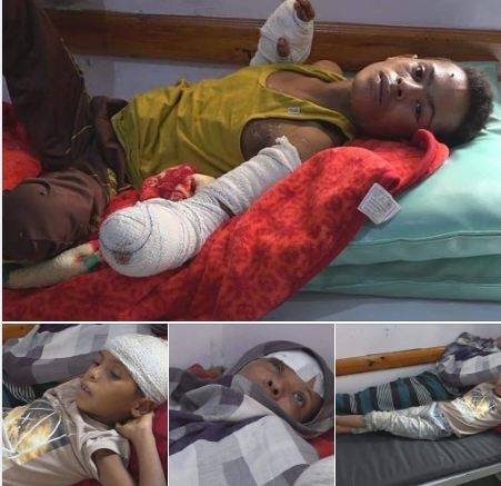 تقرير حقوقي: 21 ألف انتهاك ضد الطفولة في اليمن ارتكبها الحوثيون