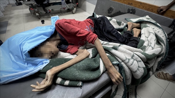 غزة تموت جوعا.. وفاة فتاة بعد انخفاض وزنها إلى النصف