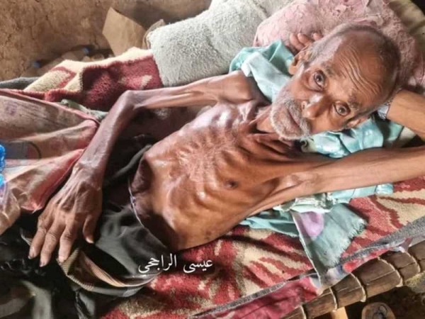 حجة.. وفاة مُسن جراء الجوع في أحد مخيمات النازحين