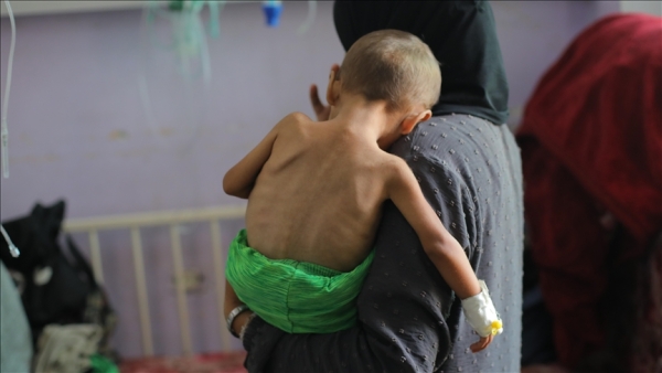 صحة غزة: ارتفاع وفيات التجويع الإسرائيلي إلى 453 بينهم 150 طفلا