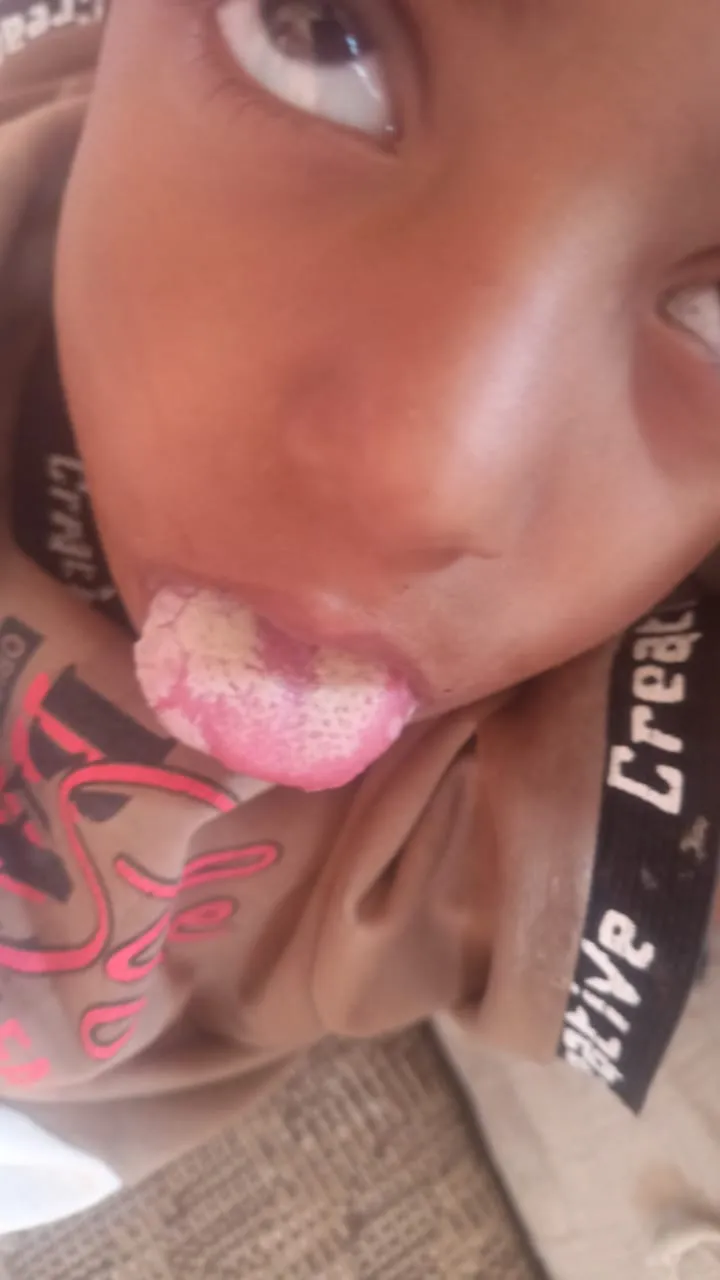 مناشدات عاجلة في الضالع جراء تفشي وباء 