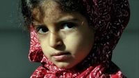"جانا".. طفلة يمنية فقدت ابتسامتها في اليمن وأعادها مستشفى بتركيا‎