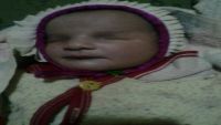 في طفرة خُلقية هي الأولى من نوعها.. ولادة طفلة في تعز فاقدةً للعيون (صورة)