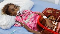 وفاة "جميلة".. الفتاة اليمنية التي أحدثت صورها ضجيجا حول العالم وتحدث عنها عسيري (صور)