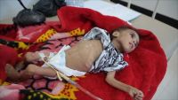 إندبندنت: أزمة الكوليرا باليمن تعزى لإستراتيجية التحالف