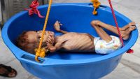 منظمة هولندية: 85 ألف طفل يمني لقوا حتفهم بسبب الجوع خلال 3 سنوات