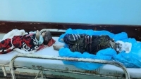 مأرب.. ارتفاع حصيلة ضحايا صاروخ الحوثي إلى 35 مدنيا بينهم أطفال ونساء