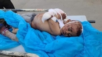 وفاة طفل متأثراً بإصابته جراء قصف الحوثي على حي سكني في مأرب