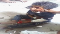 إصابة طفل بإنفجار مقذوف من مخلفات الحرب شمالي لحج