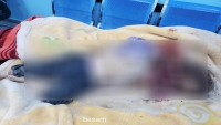 قتلى وجرحى بينهم أطفال بصواريخ طائشة اثر انفجار مخزن للذخائر بمدينة مأرب