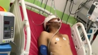 وفاة شاب وإصابة آخر بحادث مروع في إب
