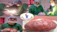 استئصال كيس يزن 14 كغم من رحم مريضة بذمار